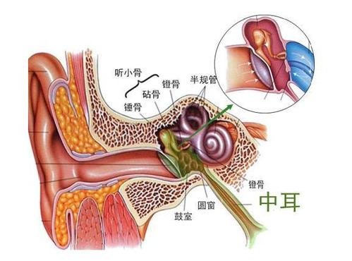 中耳炎