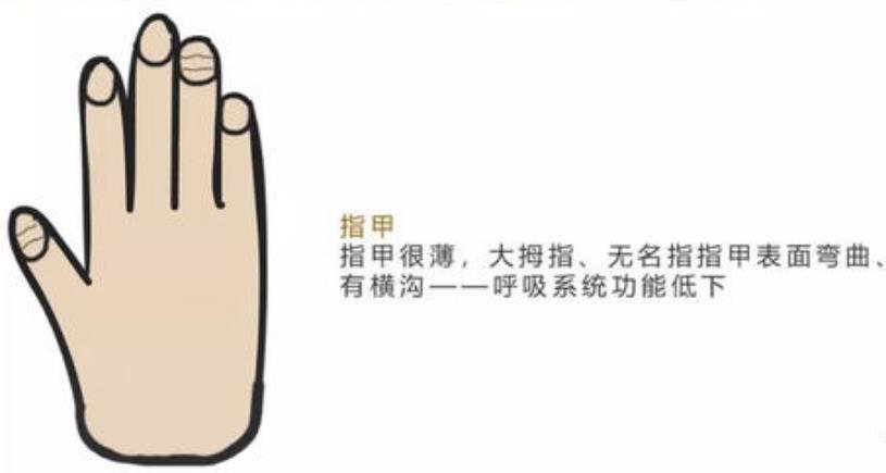 指甲上出现横沟