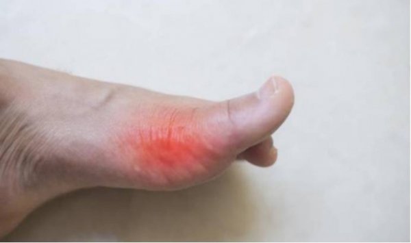 从脚上怎么看肾虚-肾虚脚上有什么症状4